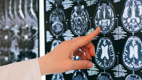 Neurocirujanos suspenden la atención para afiliados de Ioscor: críticas al Gobierno
